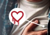 F5 presenta guía para mitigar los efectos de Heartbleed F5-Heartbleed