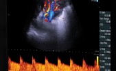 Incorporan la GPU AMD Embedded Radeon HD 7850 en aplicaciones de radiología médica Analogic bk3000 ultrasound system