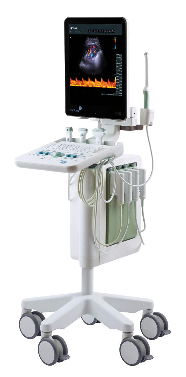 Analogic bk3000 ultrasound system-650