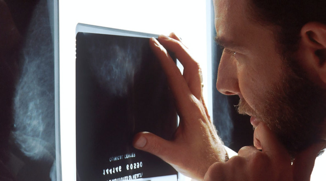 IA detecta Covid-19 analizando radiografías de pulmón